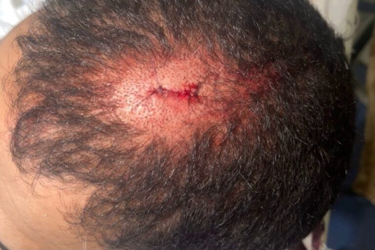 اعتداء خطير على طبيب بالمستشفى الجهوي ببني ملال اعتداء خطير على طبيب