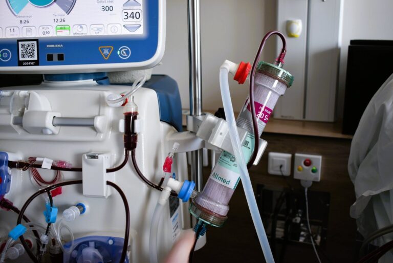 أطفال “الدياليز”